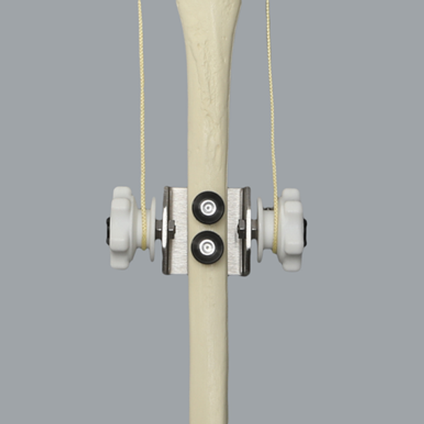 Ligament Balancer Ligament Balancer