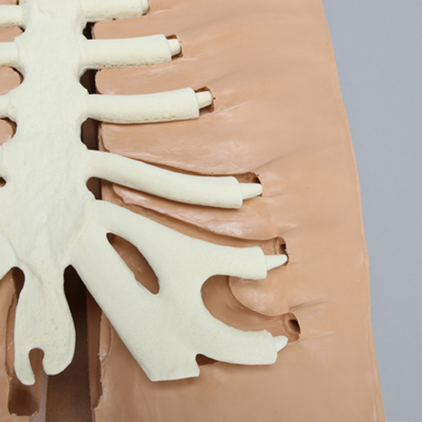 Sternum Holder