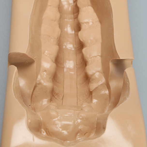 Spine Holder, T7-Sacrum with Iliac Crests