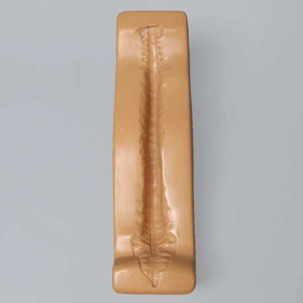 Spine Holder, Posterior C1-Sacrum, Pediatric