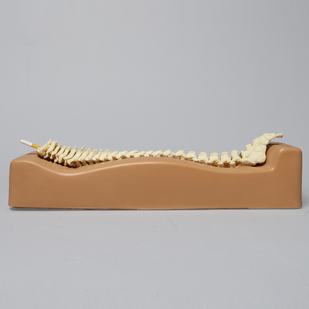 Spine Holder, Posterior C1-Sacrum, Pediatric