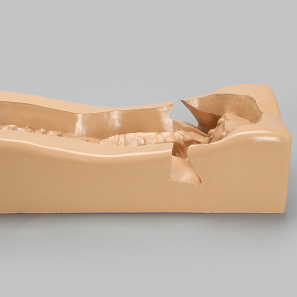 Spine Holder with Iliac Cutout