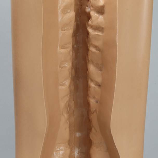 Spine Holder, Posterior T1-Sacrum