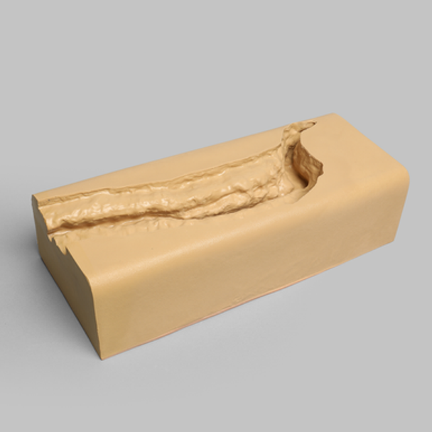 Spine Holder, Lateral T8-Sacrum