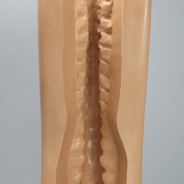 Spine Holder, Posterior C1-Sacrum