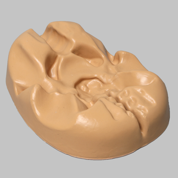 Pelvis Holder with Dual Approach