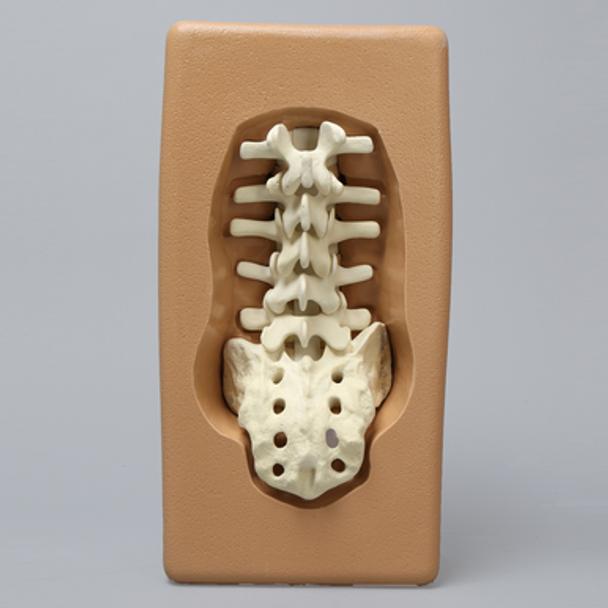 Spine Holder - L1 to Sacrum