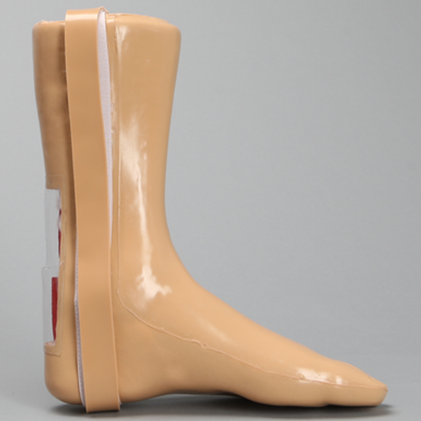 Encased Foot and Ankle with Achilles Ligament