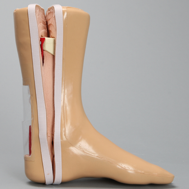 Encased Foot and Ankle with Achilles Ligament