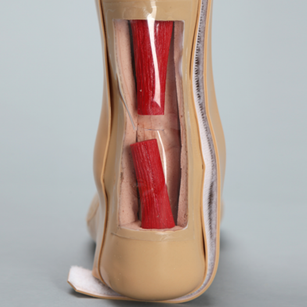 Encased Foot and Ankle with Achilles Ligament