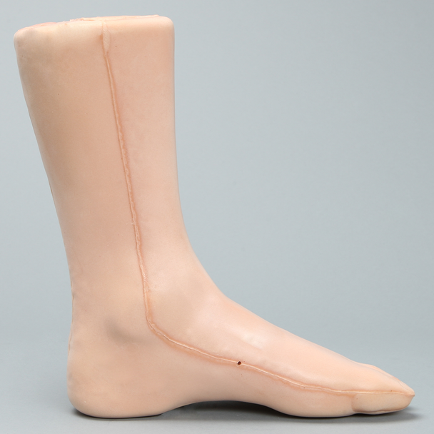 Foot and Ankle with Talar Fracture, Encased