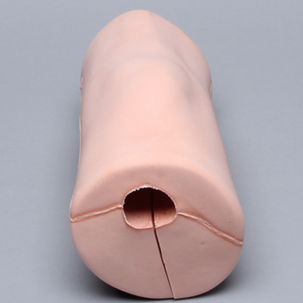 Knee Replacement Tissue, Arthroscopy