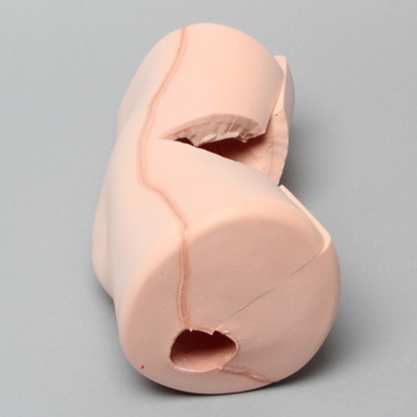 Knee Replacement Tissue, Arthroscopy
