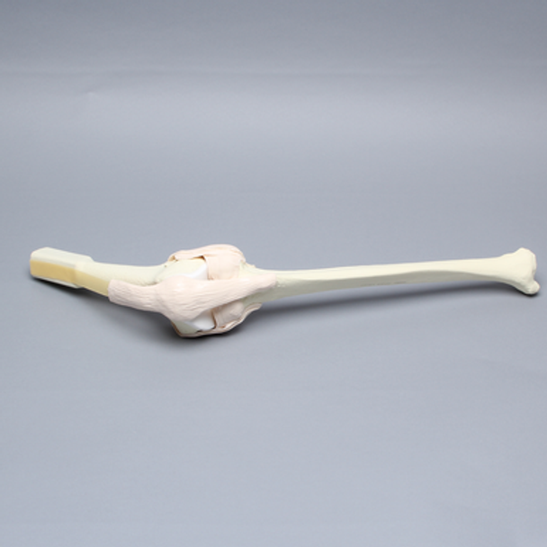 Knee Insert without ACL, Arthroscopy