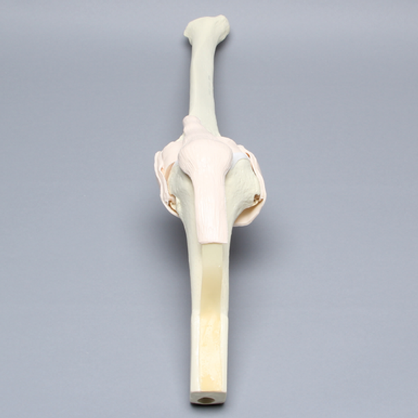 Knee Insert without ACL, Arthroscopy