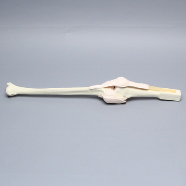 Knee Insert, Arthroscopy