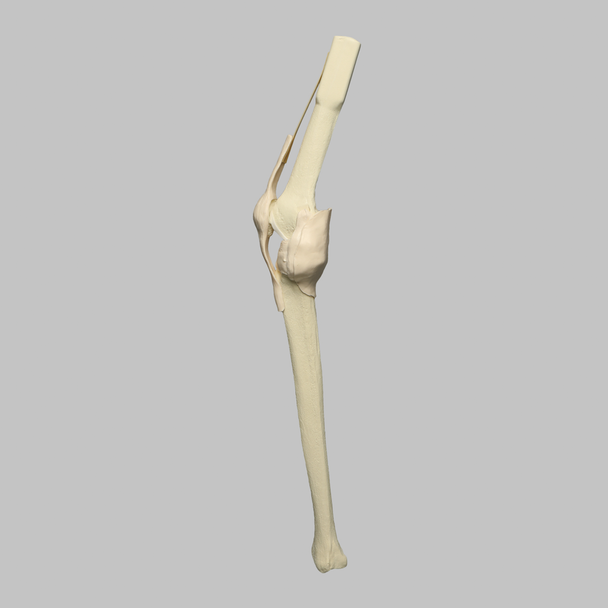 Knee Insert, Arthroscopy Knee Insert, Arthroscopy