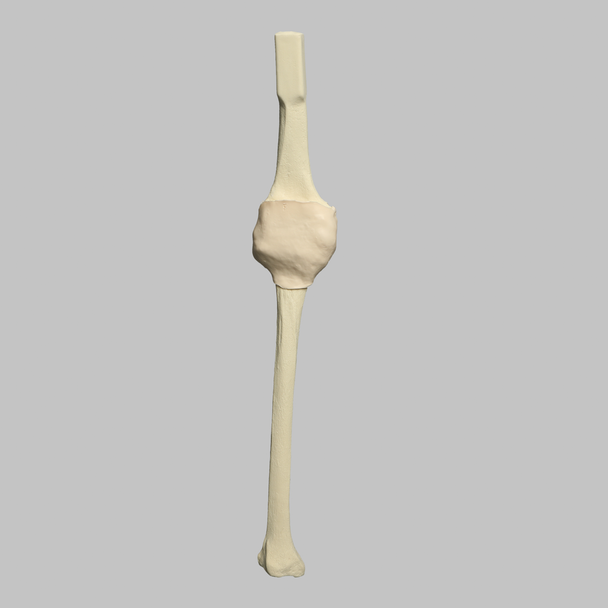 Knee Insert, Arthroscopy Knee Insert, Arthroscopy