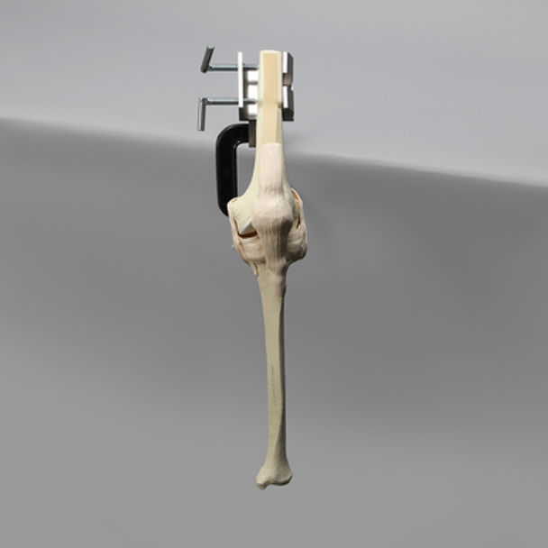 Knee, Arthroscopy