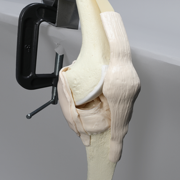 Knee, Arthroscopy