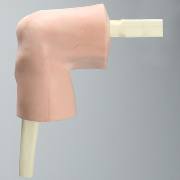 Knee, Encased