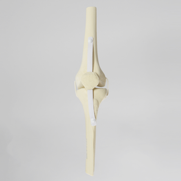 Knee Joint with Patella and Ligaments, Fully Encased