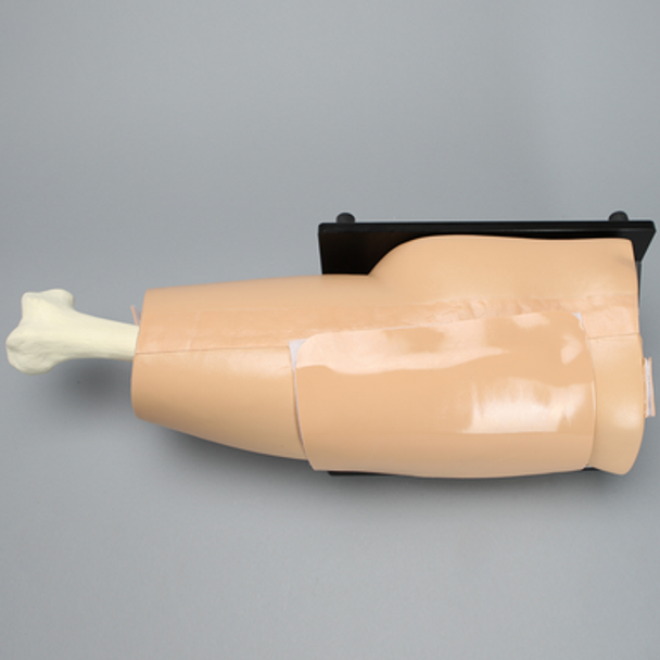 Arthroscopy Hip, on Basic Stand