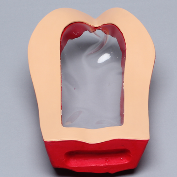 Clear Cover for Vertebroplasty Trunk #1513-38