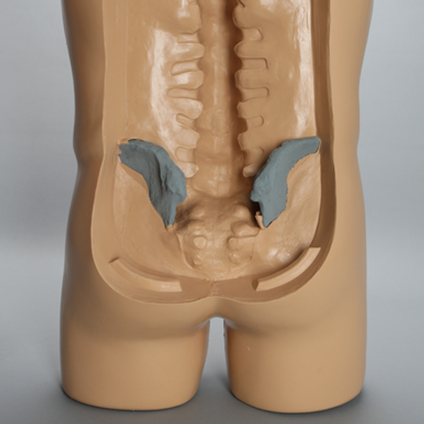 Torso, Full, Spine Holder with Radiopaque Iliac Crests