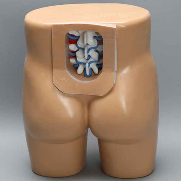 Lumbar Vertebrae Soft Tissue Trunk with Window