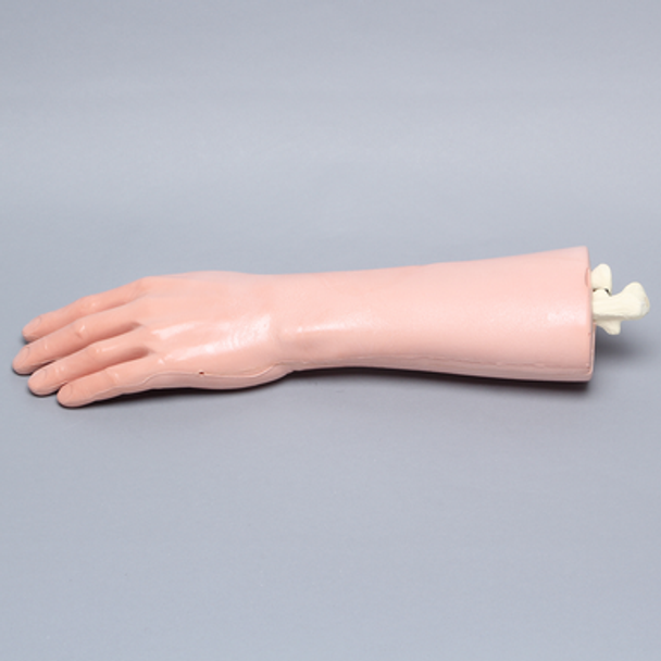 Wrist, Encased, with Transverse Fracture, Artery, Nerve, and Tendons