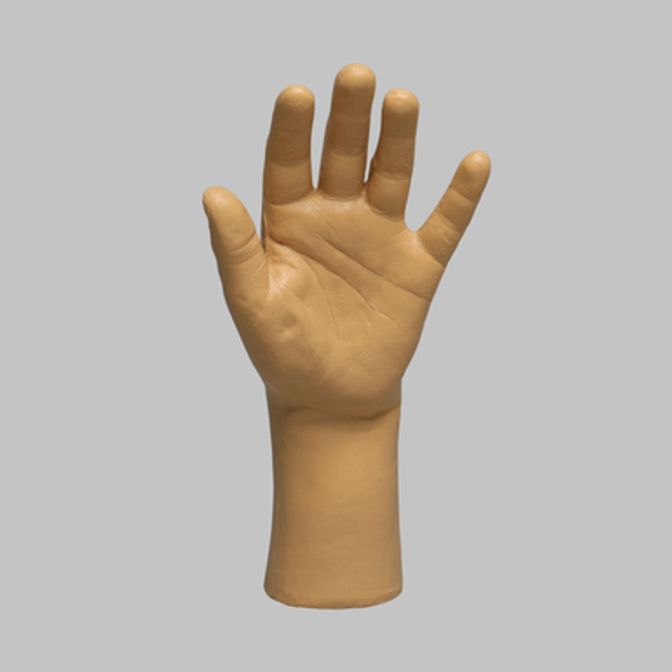 Wrist, Pediatric, Encased