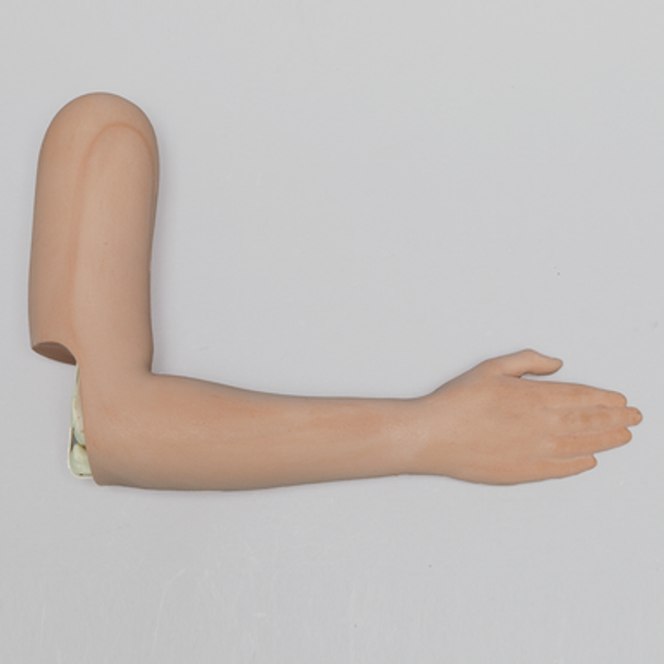 Pediatric Elbow with Supracondylar Fracture
