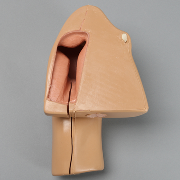 Soft Tissue Replacement for 1509-37