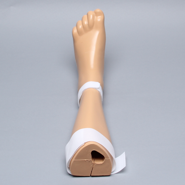 Leg Knee, Lower, Holder Replacement