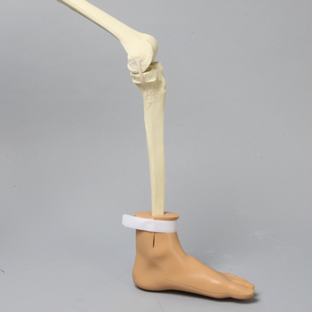 Distal Tibia Holder