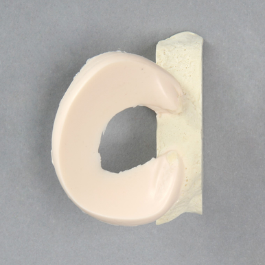 Meniscal Pad with Bone Block, Medial