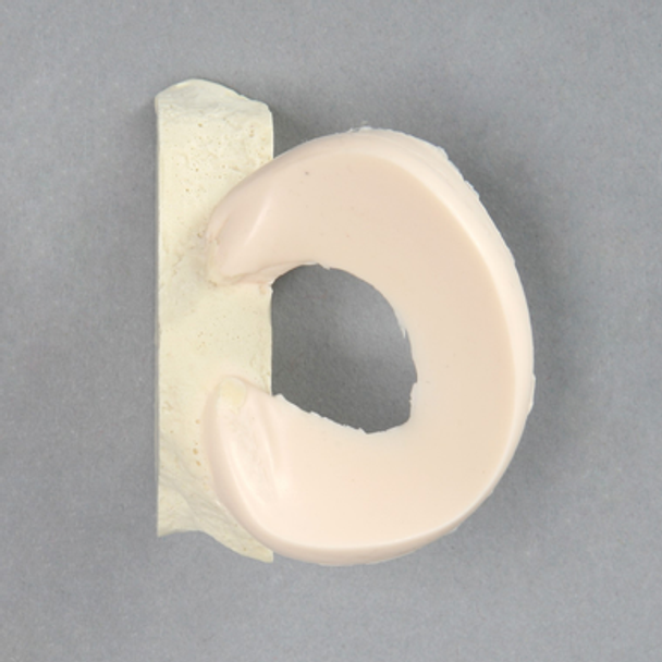 Meniscal Pad with Bone Block, Lateral