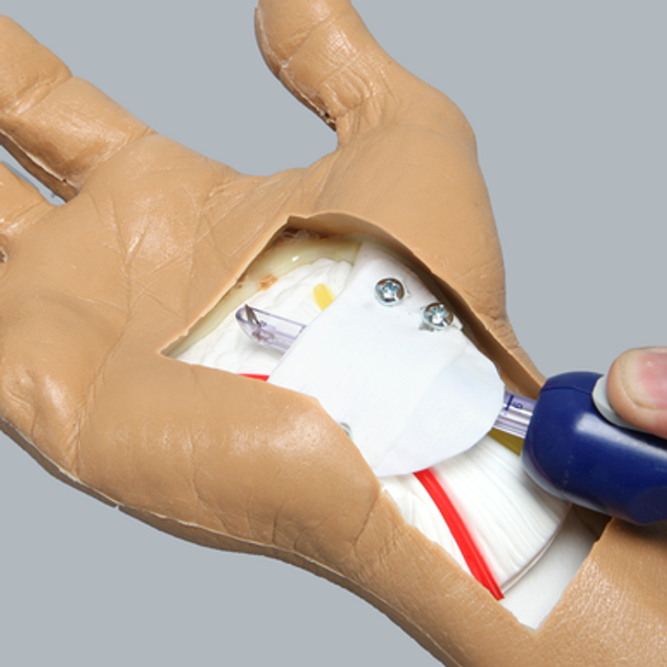Wrist Ligament, Transverse