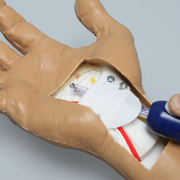 Carpal Tunnel Arthroscopy Wrist Trainer