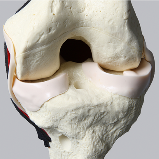 Knee, ACL with Drill Tunnels, Solid Foam