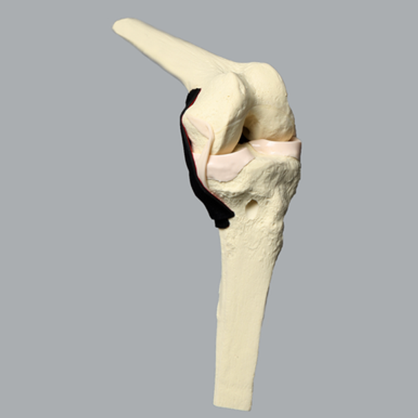 Knee, ACL with Drill Tunnels, Solid Foam