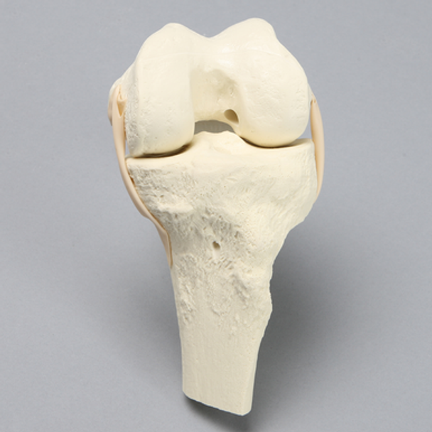 Knee, ACL Demonstrator, Solid Foam