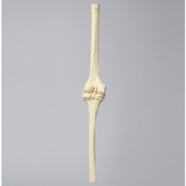 Knee Insert, ACL, Solid Foam