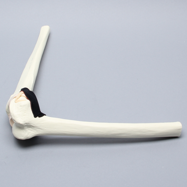 Knee Insert, Encapsulated ACL, Large