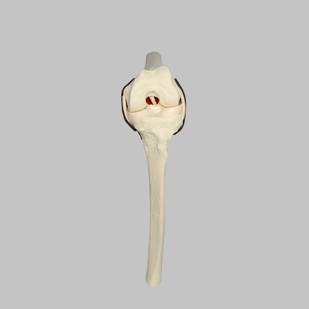 Knee Insert, Encapsulated ACL, Large