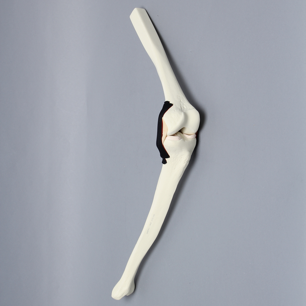 Knee Insert, Encapsulated ACL, Medium