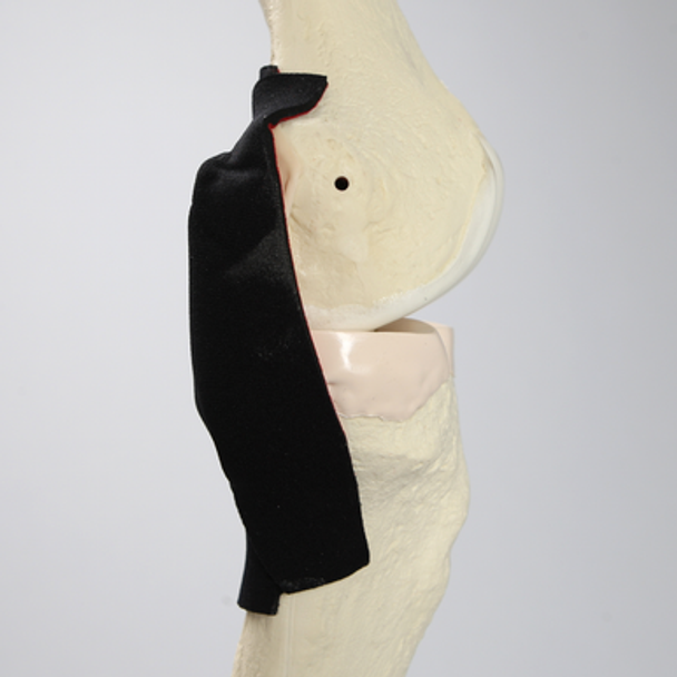 Knee Insert for #1413-20