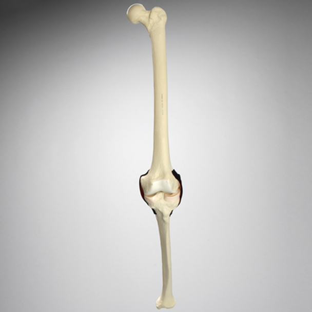 Knee Insert for #1413-20