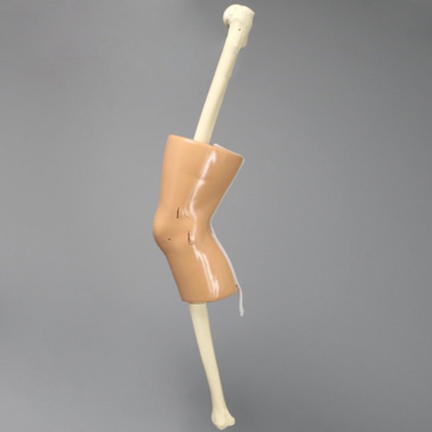 Knee, Encased with Incision Points